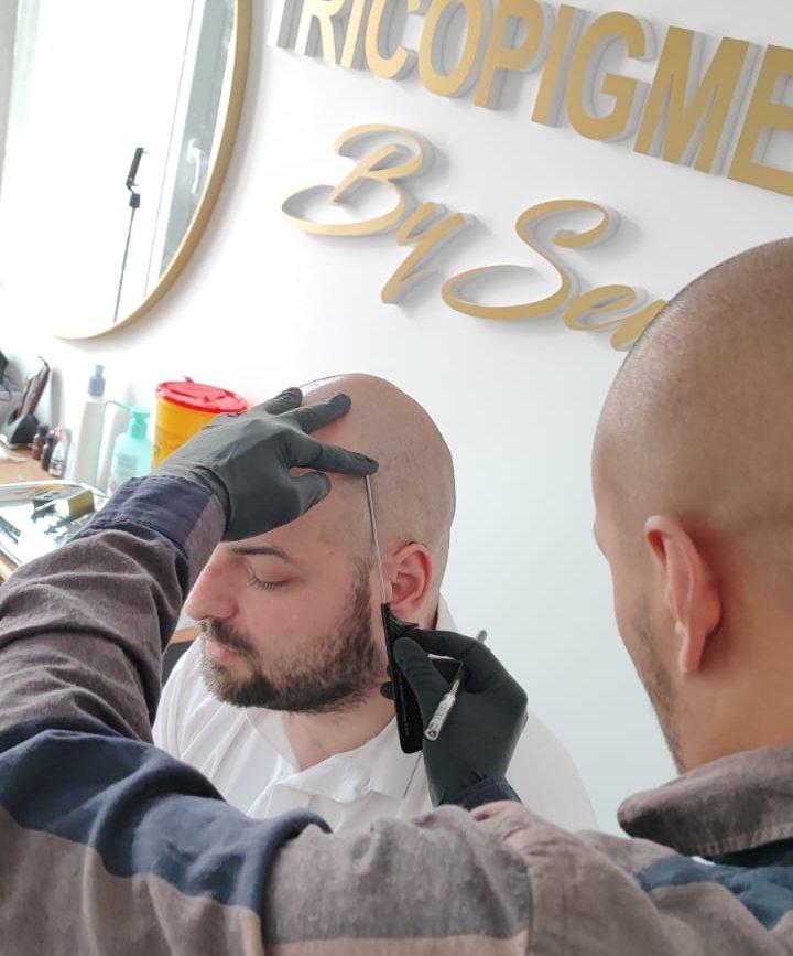 tricopigmentation semy